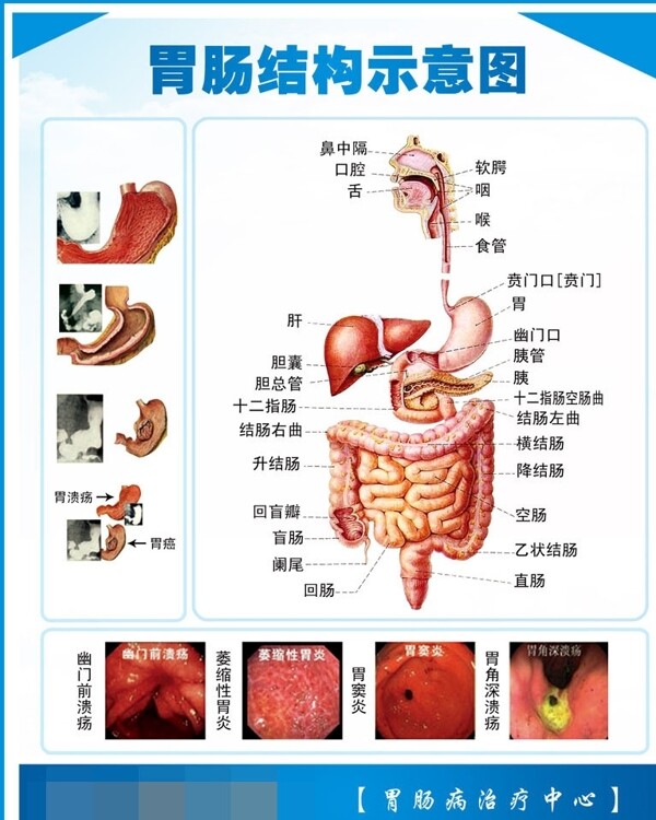 胃部肠部结构示意图图片