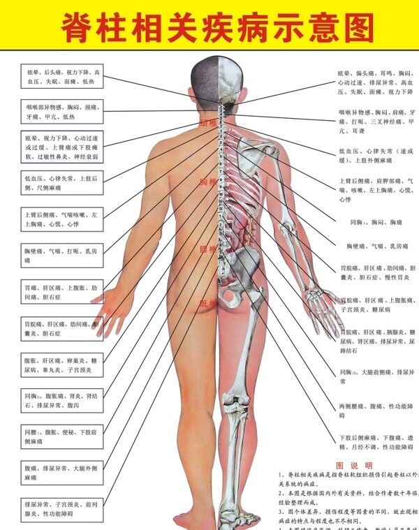 脊柱相關(guān)疾病示意圖