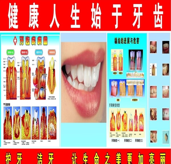 牙科圖片