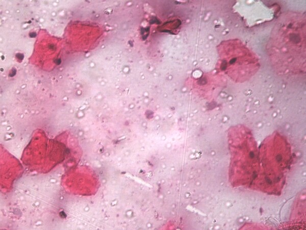 口腔粘膜细胞图片