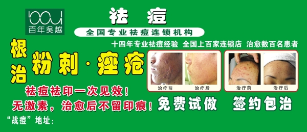 祛痘海報圖片