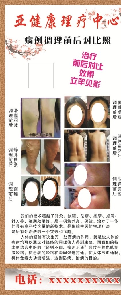 生物電宣傳展架