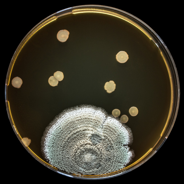 培养皿里的超大病菌图片