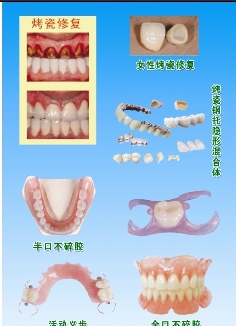 牙科宣传单海报图片