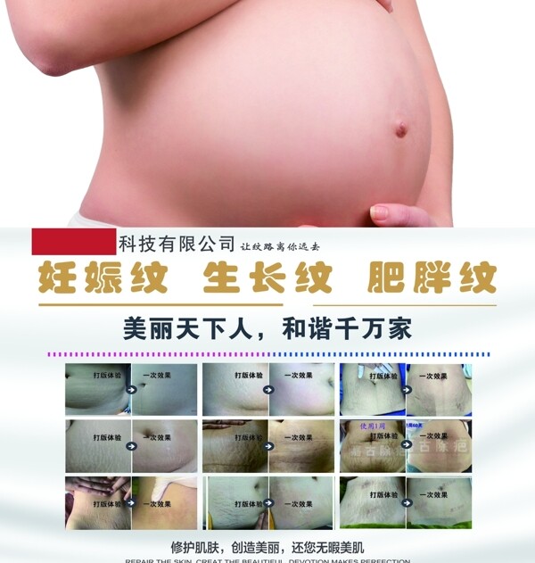 妊娠纹海报图片