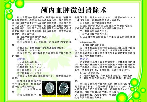 颅内血肿微创清除术图片